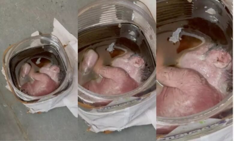 निकला बच्चे का भ्रूण