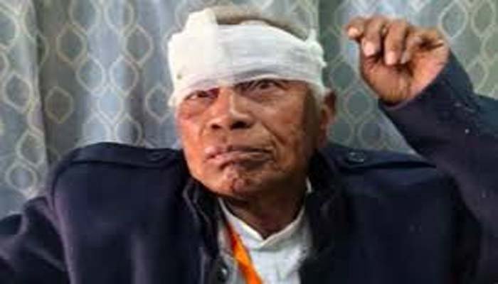 Accident of former MLA: कांग्रेस के पूर्व विधायक का हुआ एक्सीडेंट, महाकुंभ से लौटते समय हुई घटना