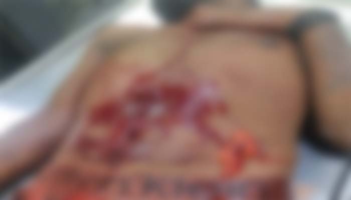 Knife stabbing in Bilaspur: दो गुटों के बीच चाकूबाजी, 2 युवकों की हालत गंभीर, 4 आरोपी हिरासत में