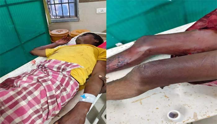 Elephant Attack: जंगल में लकड़ी लेने गए ग्रामीण पर दंतैल हाथी ने कुचला, हालत गंभीर