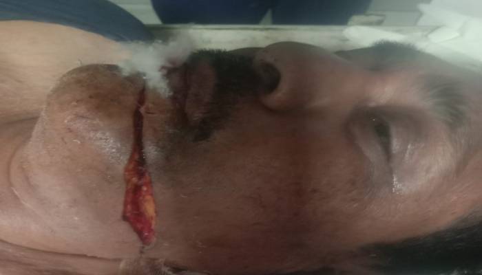 Chinese Manjha Incident: राजधानी में चाइनीज मांझा से फिर हादसा, स्कूटी सवार बुजुर्ग घायल 1 Chinese Manjha Incident: राजधानी में चाइनीज मांझा से फिर हादसा, स्कूटी सवार बुजुर्ग घायल