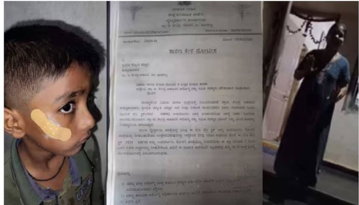 LAPARVAHI: नर्स ने घाव पर टांके लगाने की बजाय लगाया फेविक्विक, निलंबित