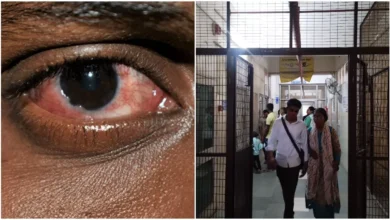 28 07 2023 eye flu 23484855