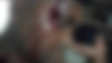 सरपंच प्रतिनिधि पर जानलेवा हमला, 2 आरोपी रडार पर