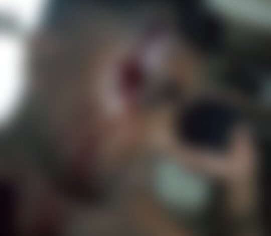 Attack on Sarpanch: सरपंच प्रतिनिधि पर जानलेवा हमला, 2 आरोपी रडार पर 1 सरपंच प्रतिनिधि पर जानलेवा हमला, 2 आरोपी रडार पर