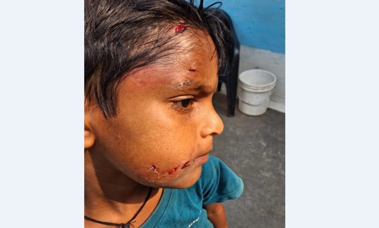 Danger In School Premises