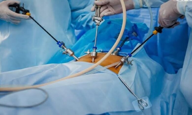 Free Spine Surgery Camp