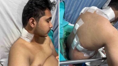 बिलासपुर में कांग्रेस नेता के बेटे पर जानलेवा हमला, गंभीर हालत में किम्स अस्पताल में भर्ती, आरोपी फरार 2 bpl