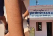 सरकारी स्कूल में 35 बच्चों ने ब्लेड से काटी कलाई, प्रशासन के उड़े होश 23 image 2026 02 19T090621.255