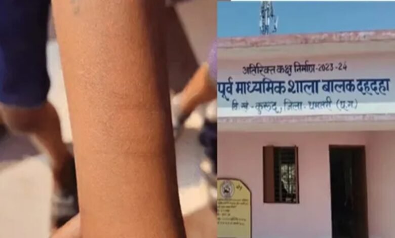 सरकारी स्कूल में 35 बच्चों ने ब्लेड से काटी कलाई, प्रशासन के उड़े होश 1 image 2026 02 19T090621.255