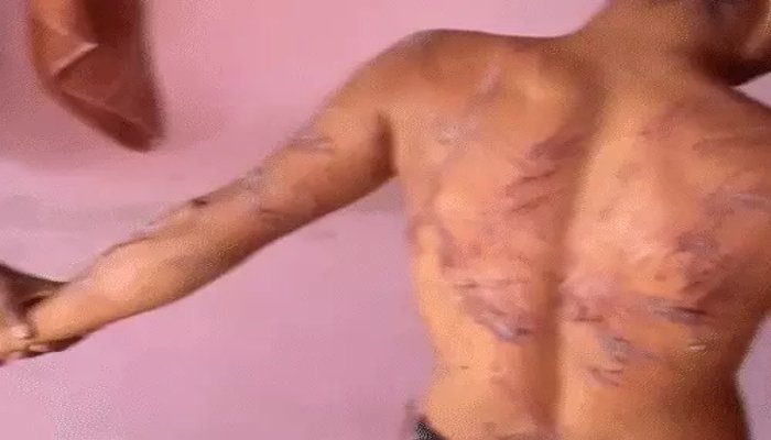 नशामुक्ति केंद्र में दरिंदगी: आदिवासी युवक को पाइप से पीटा, वीडियो वायरल, आरोपी पर FIR 1 image 1 34