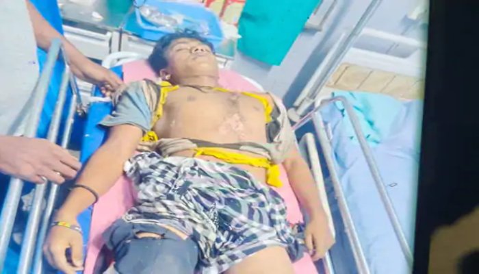 दुर्ग में क्रिकेट खेलते समय गिरी बिजली, 12वीं के छात्र की मौत: बारिश से बचने भाग रहा था युवक, अस्पताल में डॉक्टरों ने मृत घोषित किया 1 image 8 3